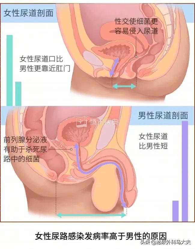 绝经期女人为什么会经常尿路感染,绝经女性尿路感染的原因