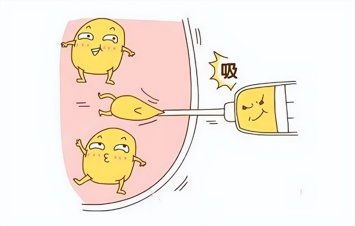 九院韦敏面部吸脂,九院韦敏植骨手术案例