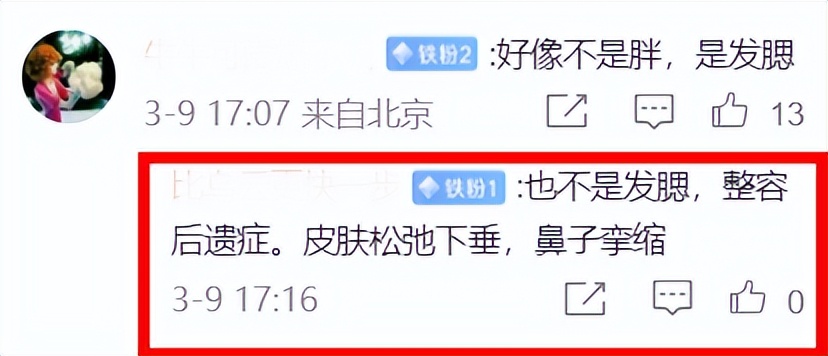 李钟硕的双眼皮长大变单眼皮,韩星李钟硕近照曝光