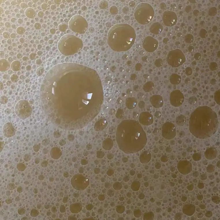 妇科白带水样带脓性怎么回事,如何分清是水样白带还是脓性白带