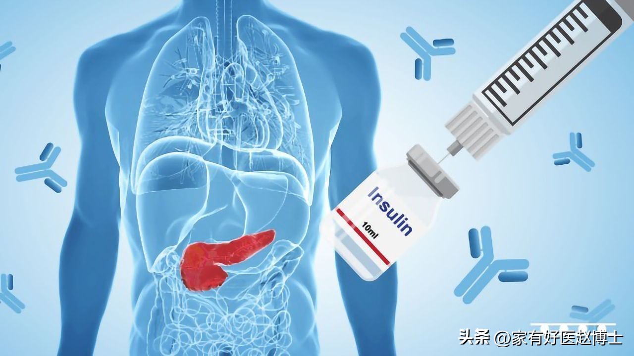 有没有胰岛素抵抗治好的,胰岛素有没有抵抗怎么看