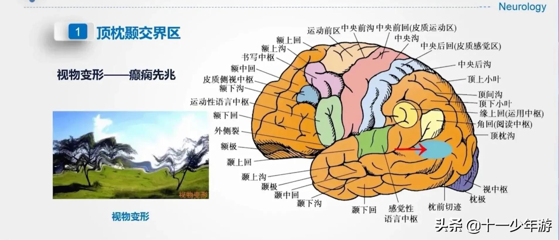 大脑的结构解剖示意图,大脑镰下疝解剖结构
