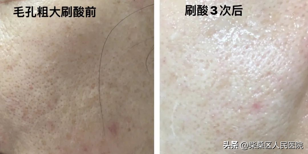 【医疗惠民】柴桑区人民医院3.8女神节优惠活动又来啦！