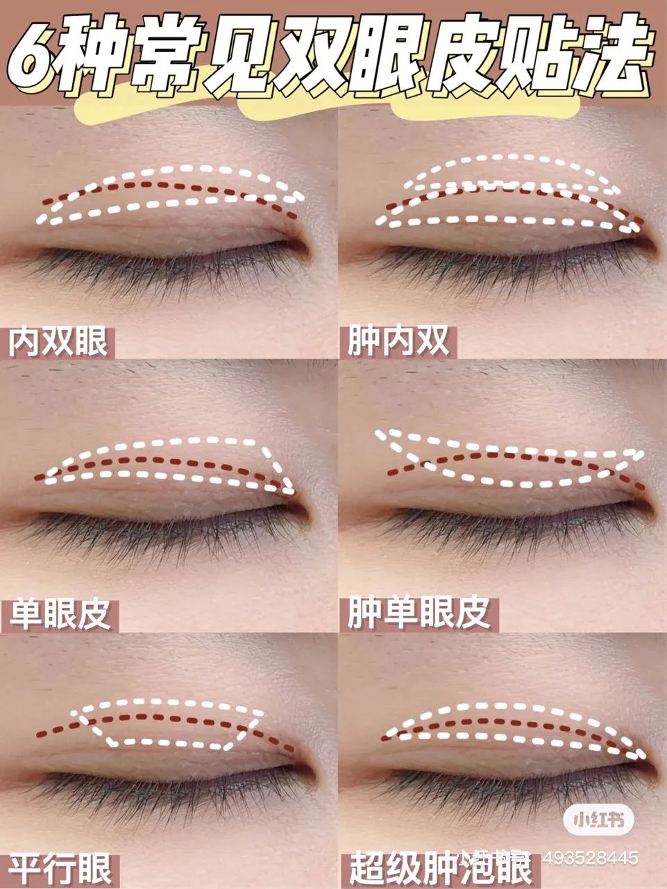 女生为了变美到底有多假动漫版,女生为了变美做整容手术