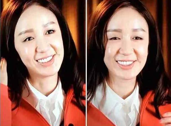 因整容毁掉前途的女星,整容改命的五位明星