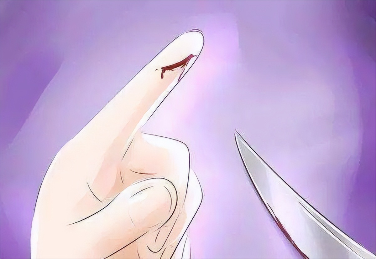 为什么手术划开皮肤不会流血,不小心割到皮一直流血怎么办