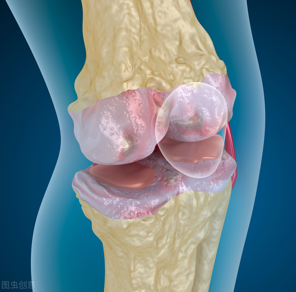 诊断半月板损伤的实验方法,膝关节半月板损伤鉴别诊断