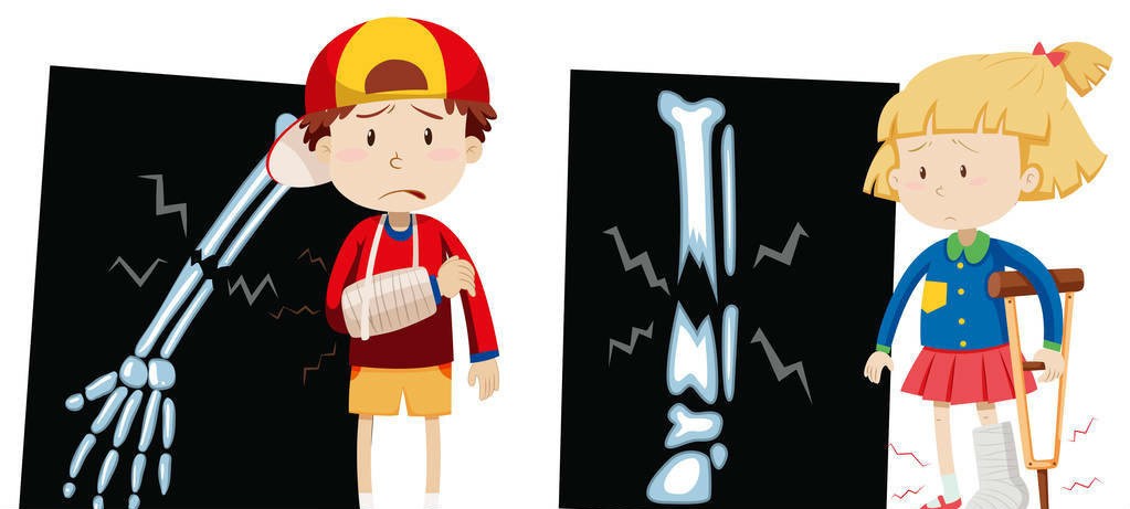 如何促进骨折愈合预防并发症,骨折的预防注意事项