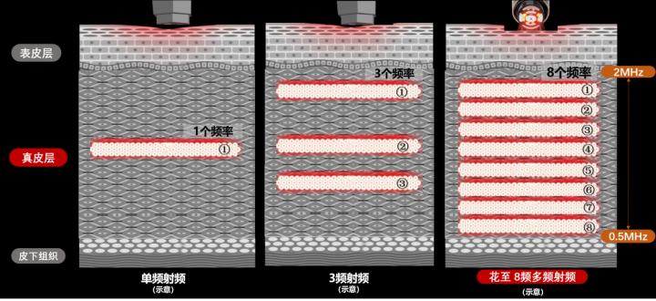 国产美容仪哪个靠谱,哪种平价美容仪最值得入手