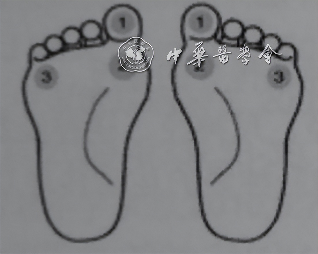 糖尿病病友自我管理手册,2022版ada糖尿病诊疗标准