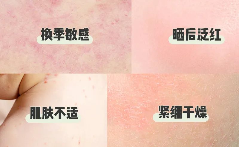 雅漾喷雾就是矿泉水吗,雅漾喷雾和矿泉水有什么区别