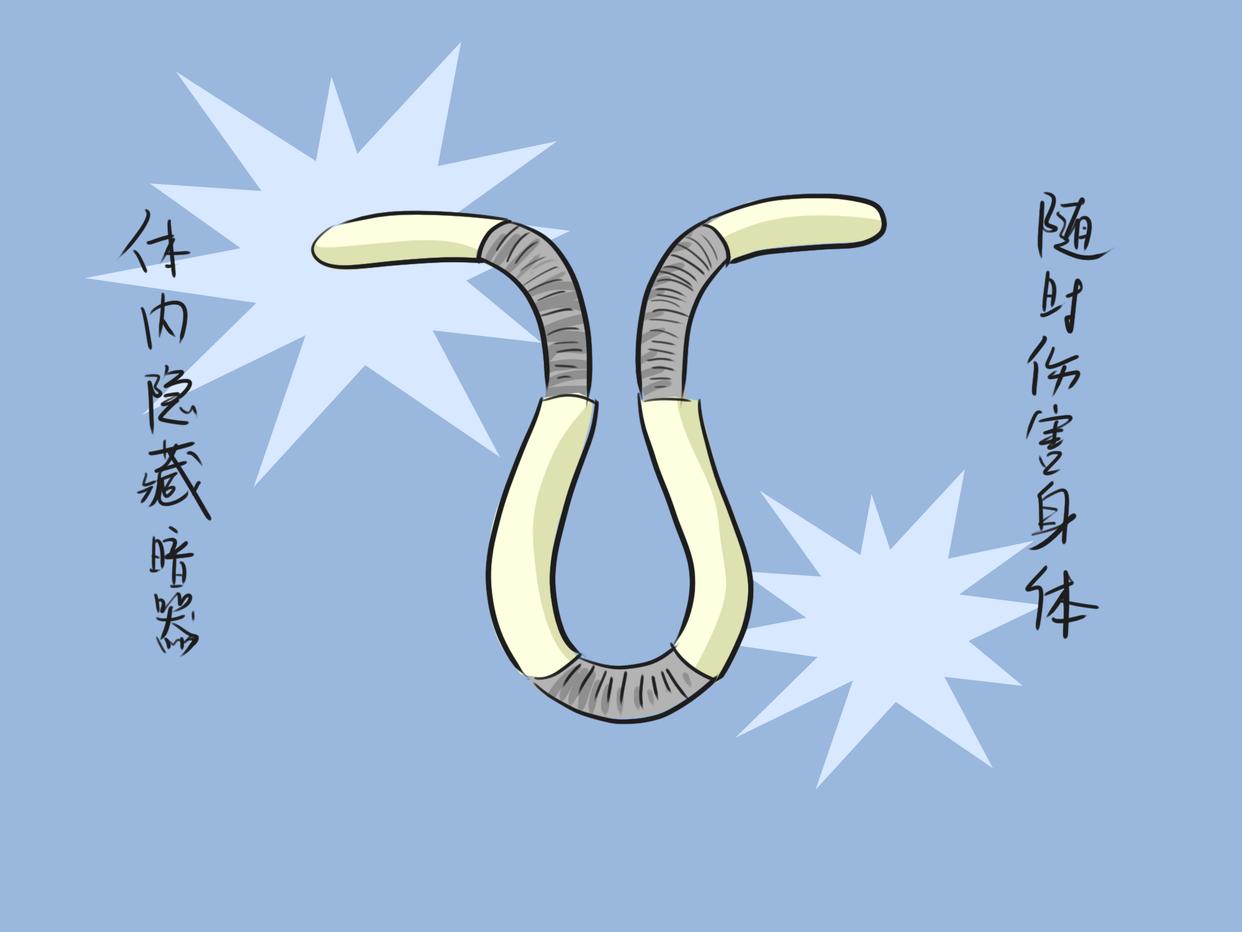 节育环在什么情况下会发生移位,节育环位置正常会引起妇科病吗