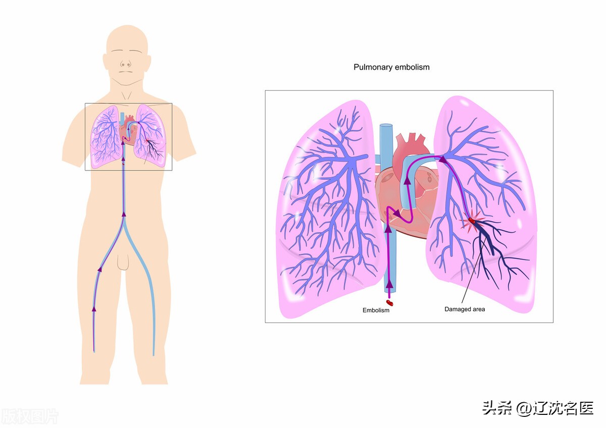小伙突发胸痛,小伙子突发呼吸困难