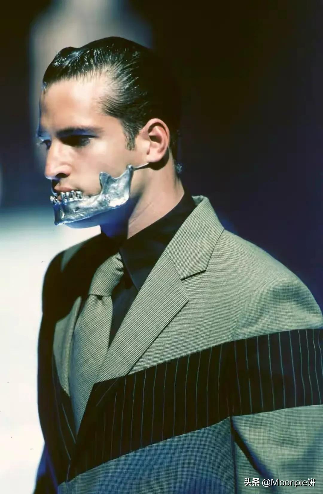 为什么胼胝体会缺失,schiaparelli水平