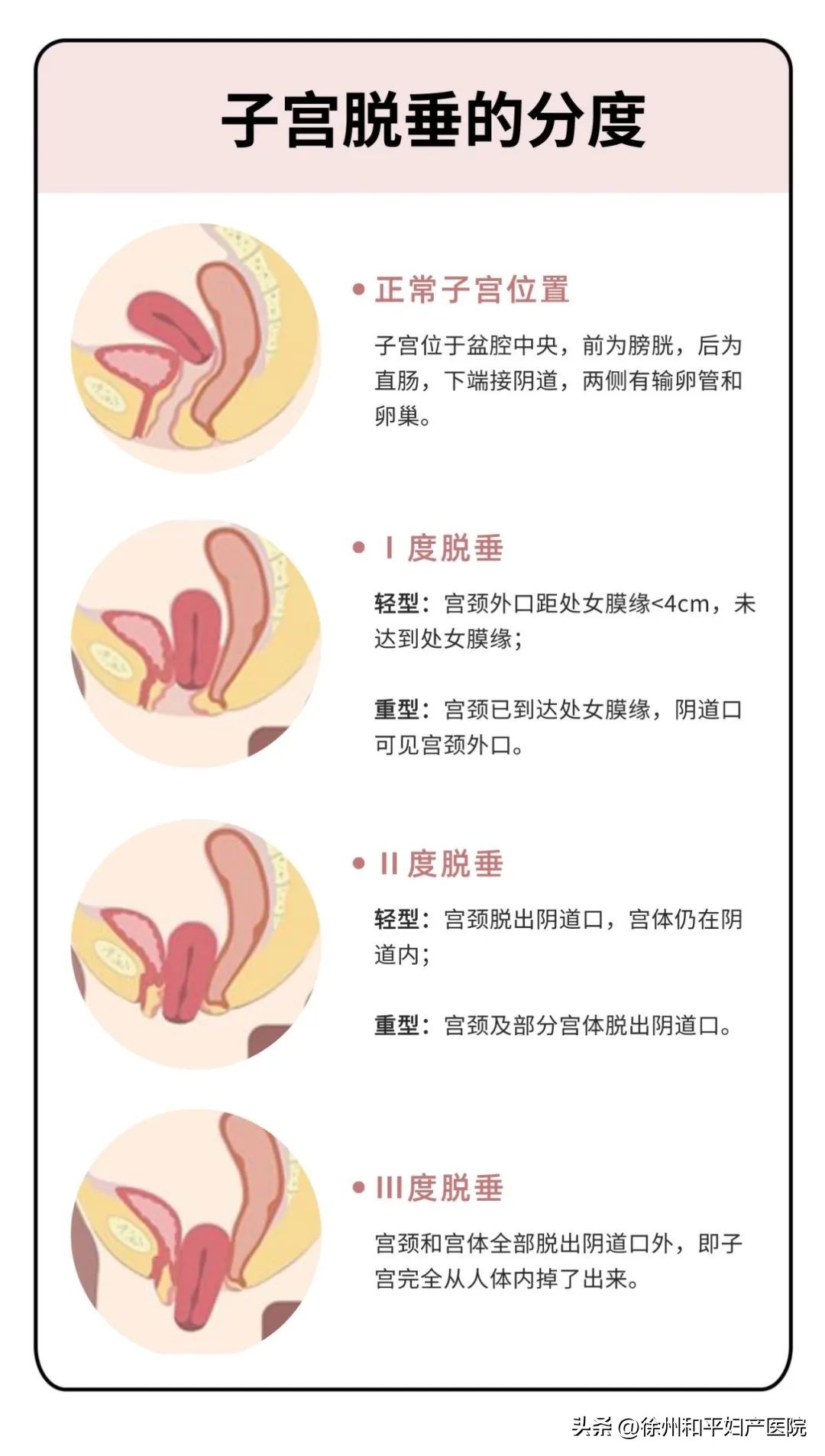 18岁女孩放超大响屁，竟把子宫从身体喷了出来？！