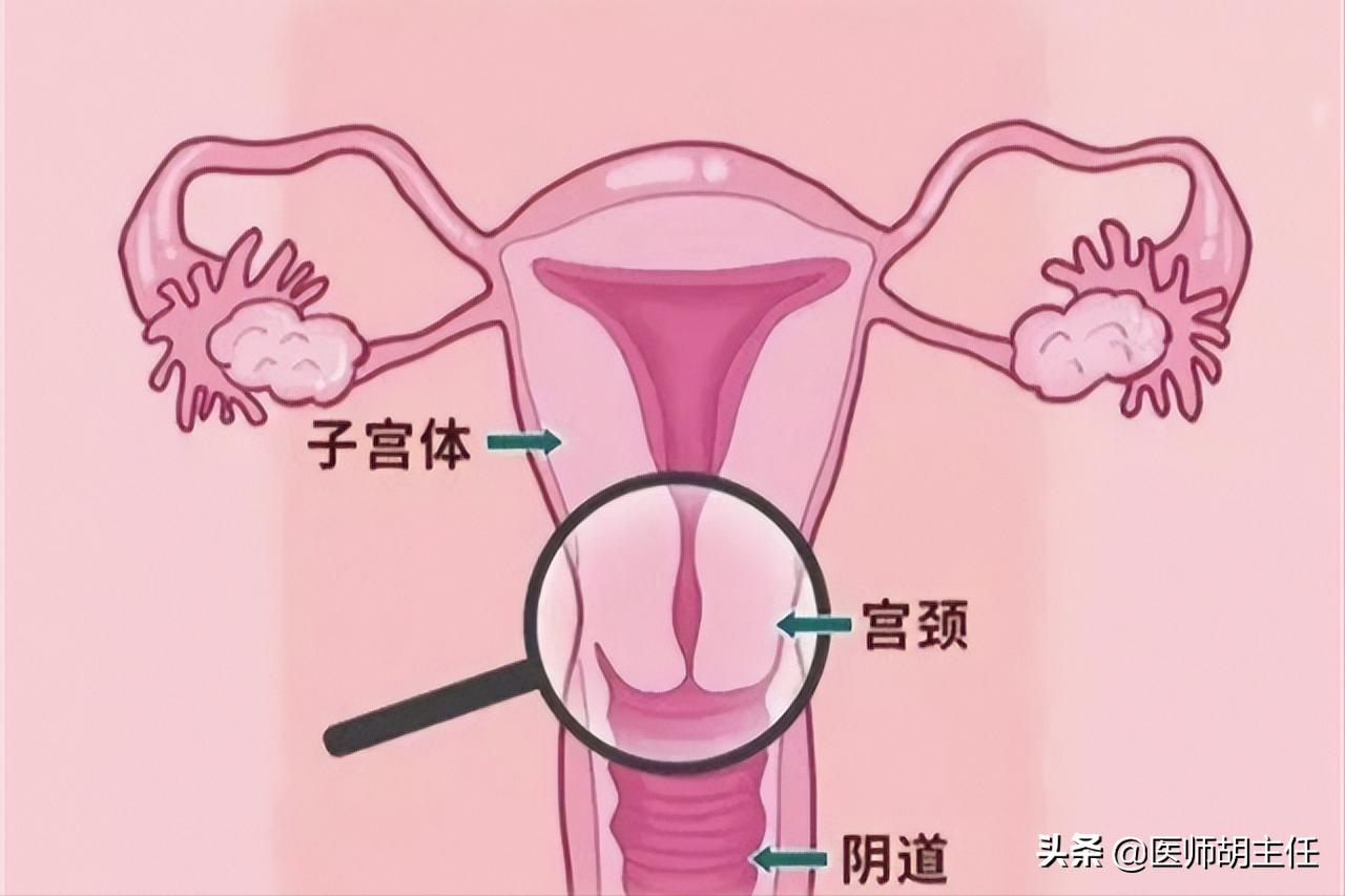 30岁腿痛查出宫颈癌案例,宫颈癌晚期腿上4个信号提示