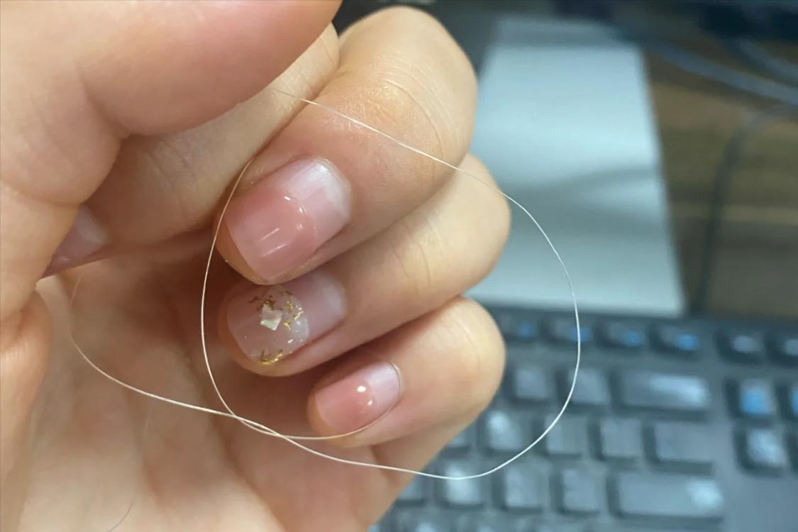 突然发现长了好多白头发怎么回事,突然发现自己长白发是什么原因