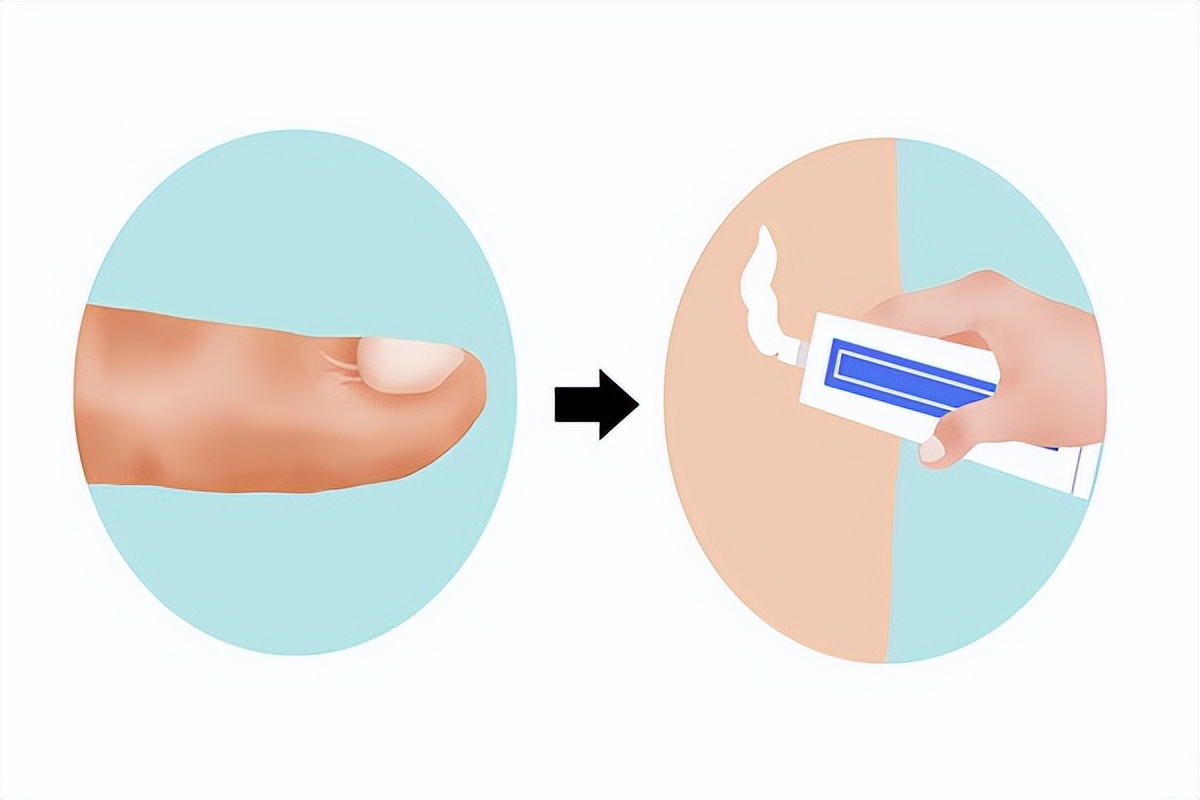 芦荟胶怎么抹脸效果好,芦荟胶怎么擦脸最有效果