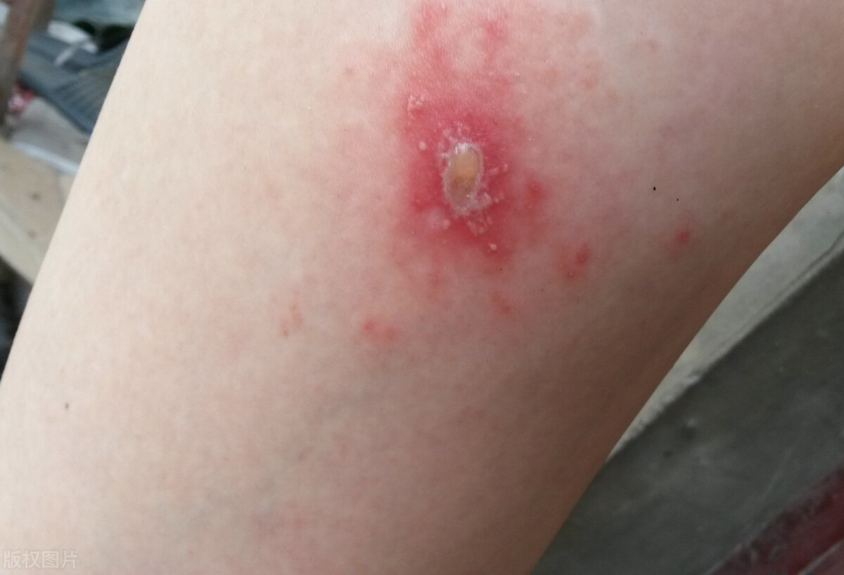 生活中什么虫子有毒,生活中不可惹的虫子