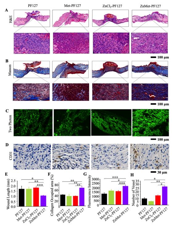 「科研快报」可喷雾热敏水凝胶与锌修饰二甲双胍促进皮肤创面愈合