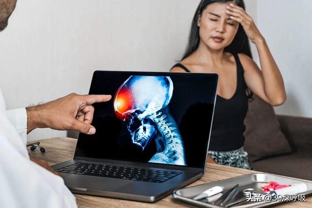 偏头痛新药,重磅偏头痛新药