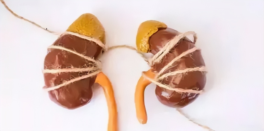 肾结石能吃蛋一类的食物吗,肾结石治疗期间可以吃鸡蛋吗