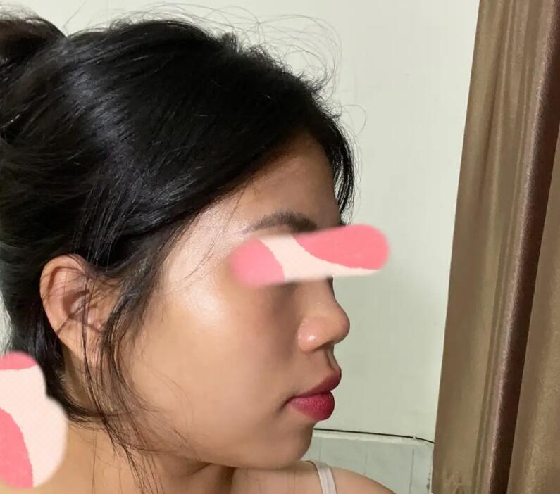 同样都是“凸嘴”，为什么有人风情万种，有人一股土味？答案在这