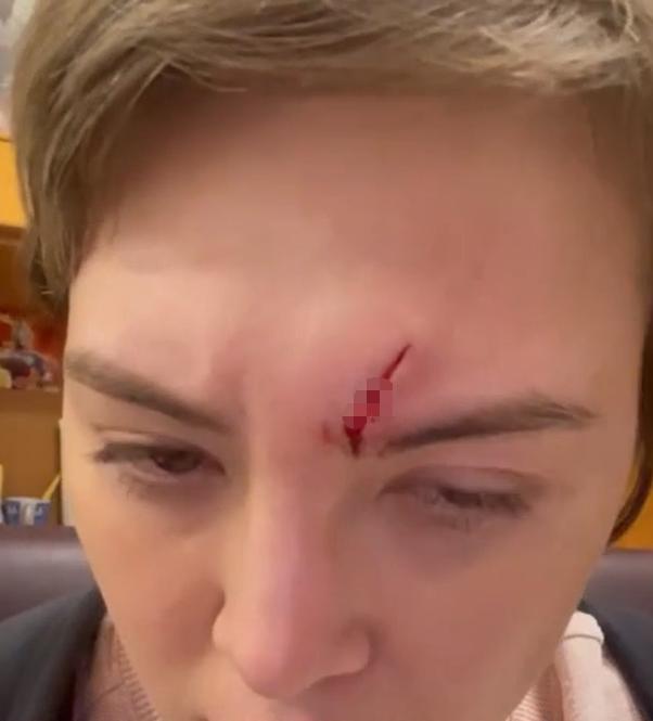 31岁知名女明星出车祸,31岁女演员车祸