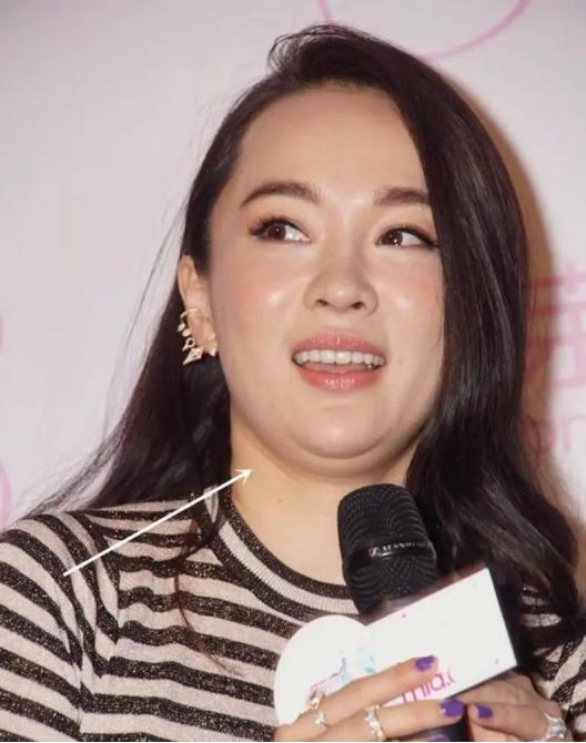 怀孕胖瘦下来的女明星,怀孕胖了又瘦的女网红