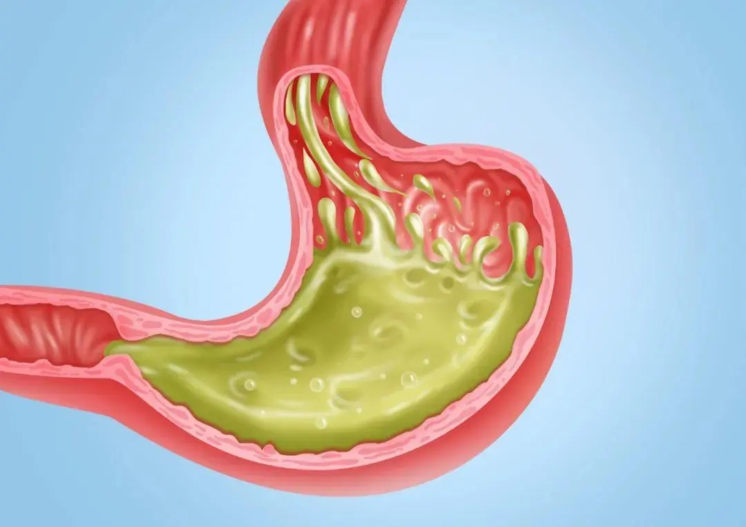 长期不吃晚饭的人最后会怎样,坚持不吃晚餐的人后果