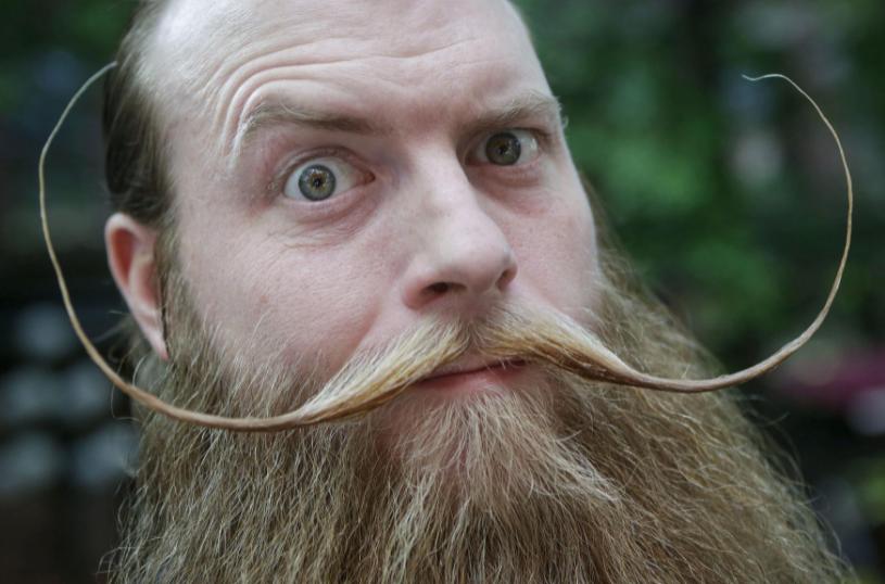 男人胡子长意味的什么,男人胡子长得快是什么病