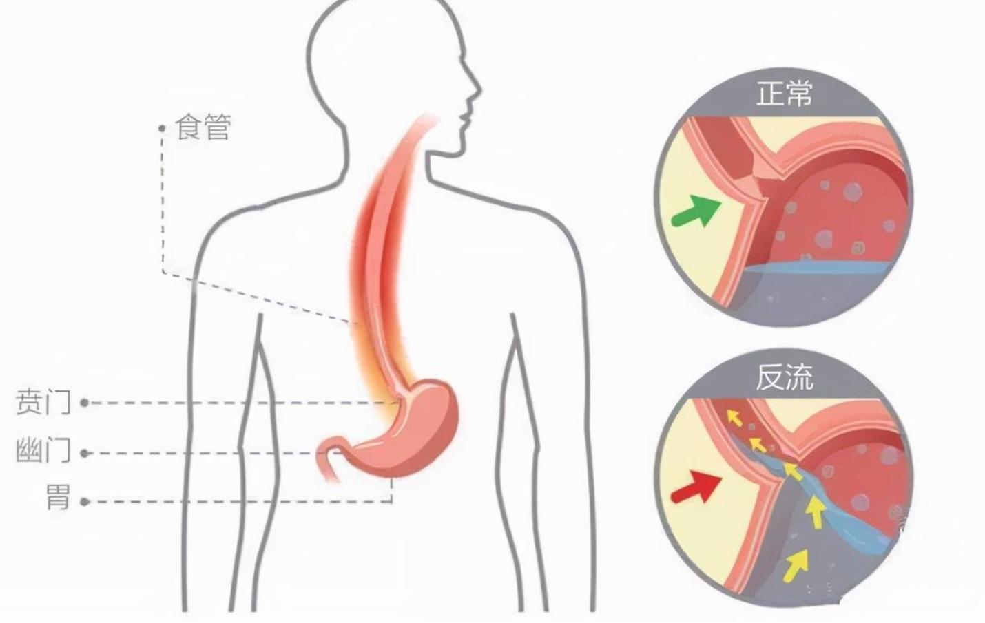 睡觉流口水要警惕四种疾病,睡觉流口水是什么病的前兆