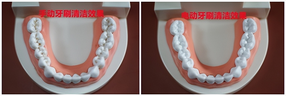 电动牙刷刷牙有危害吗,宝宝用电动牙刷的危害