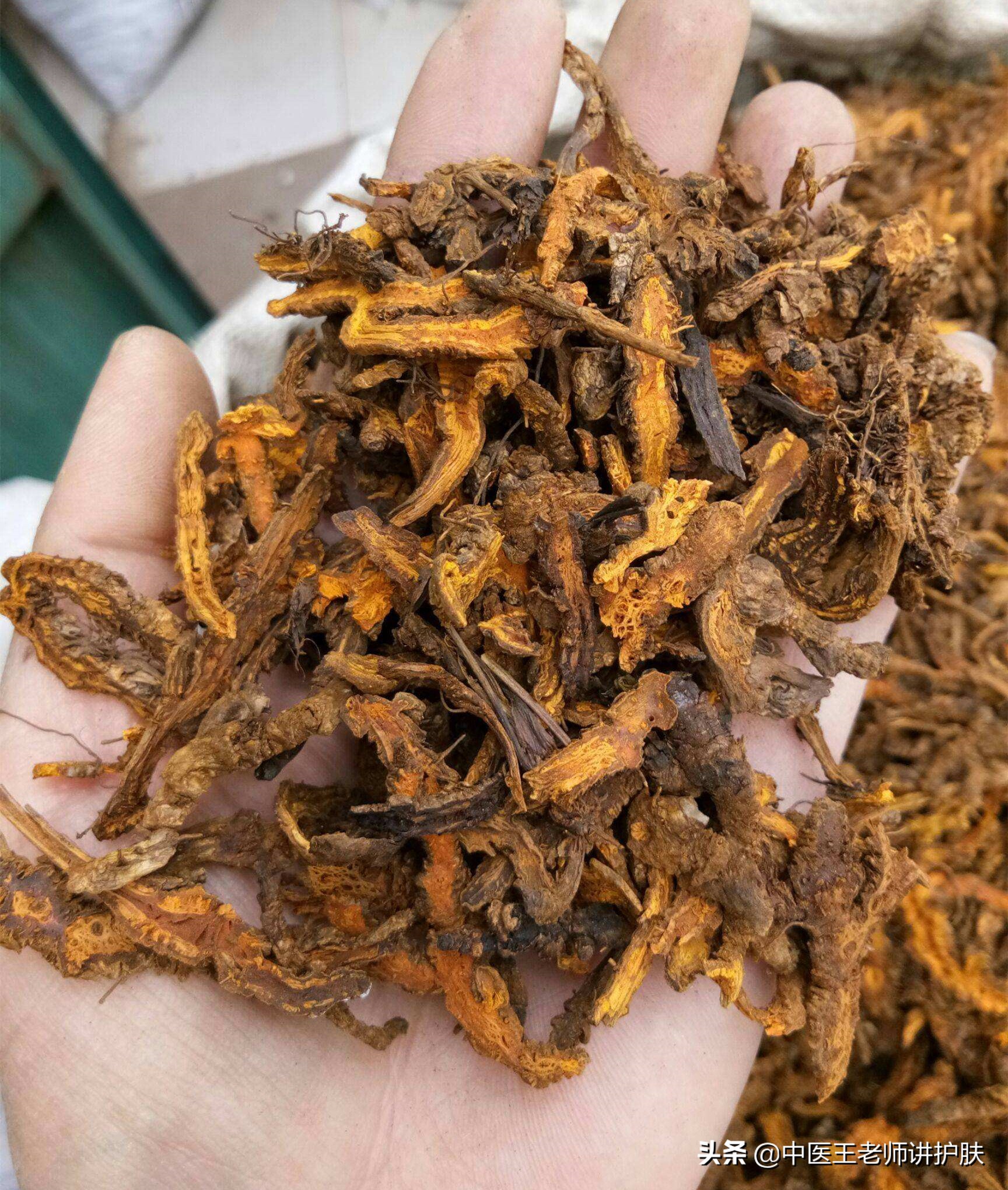 面部激素依赖性皮炎最佳治疗方法,面部激素依赖性皮炎能治好吗