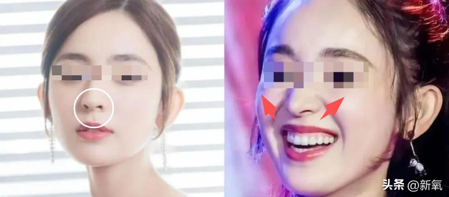 6位一大笑颜值就会崩塌的女明星,看起来笑的很魔性的女明星