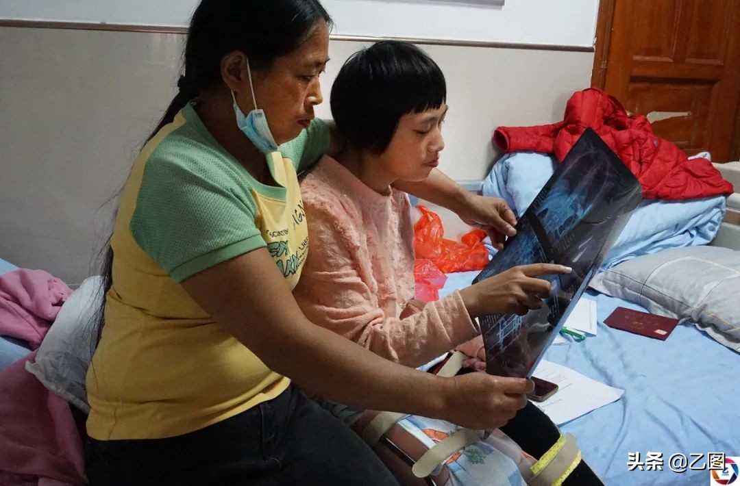 孕妇临盆前发生意外,孕妇脱离危险生孩子