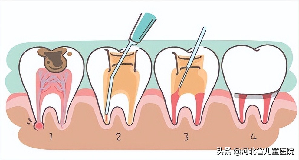 造血干细胞移植后口腔出现血泡,造血干细胞移植后口腔护理