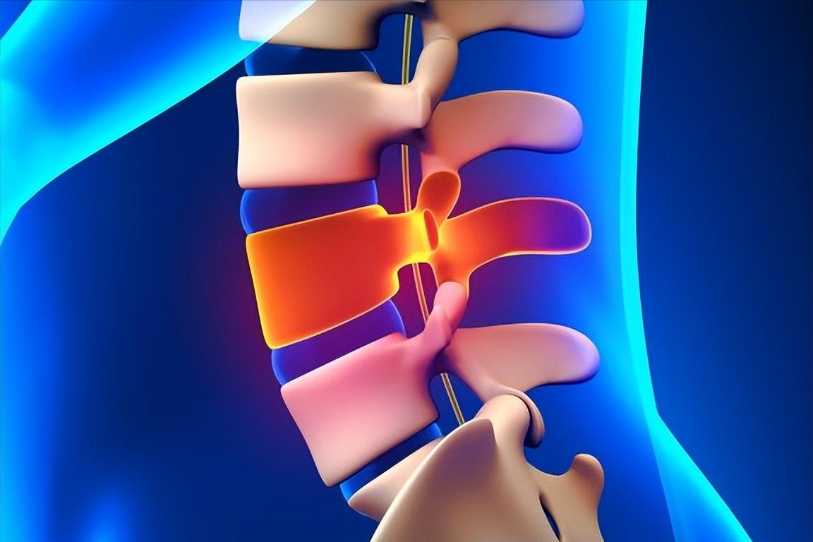 腰椎间盘突出是什么原因引起的,腰椎间盘突出症状表现3d动画