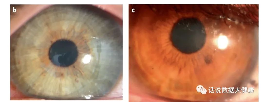 浜哄伐瑙掕啘瑙嗗姏鎭㈠,鐪肩潧澶辨槑鏇存崲浜哄伐瑙掕啘