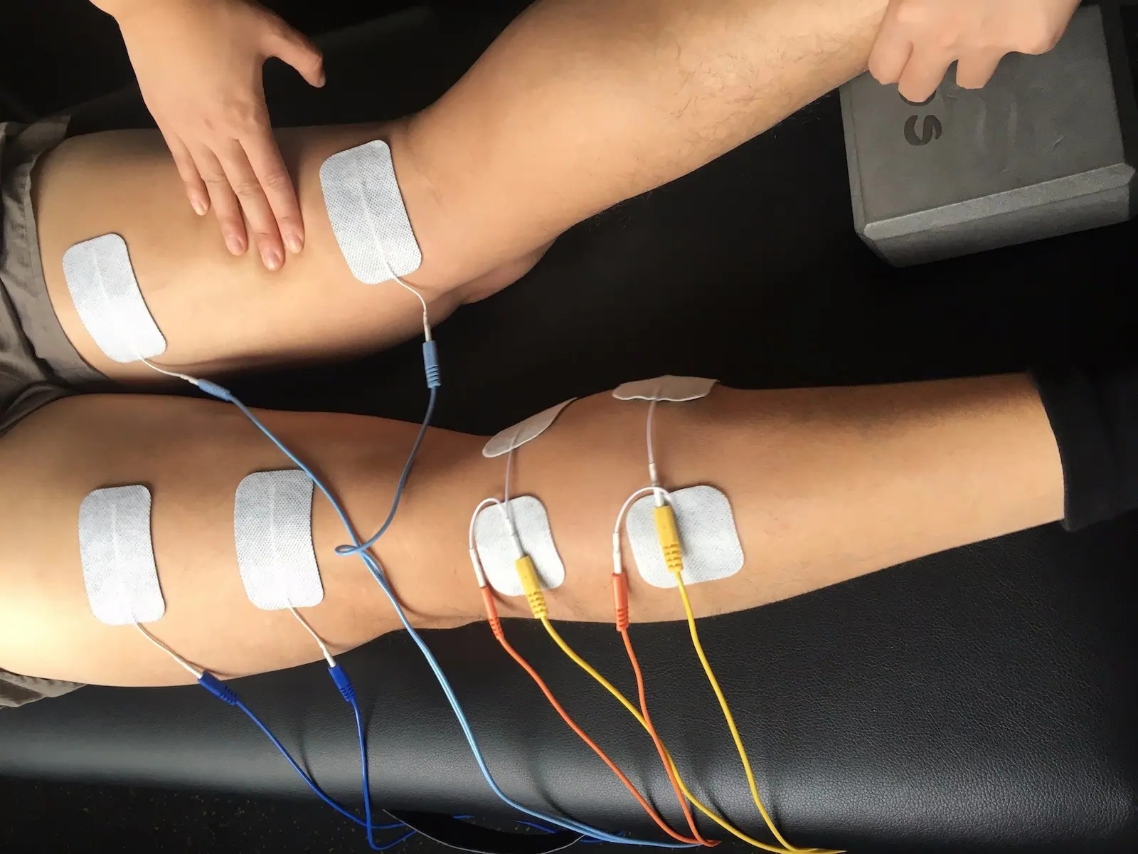 电疗治偏瘫起什么作用,中频电疗仪对偏瘫的作用