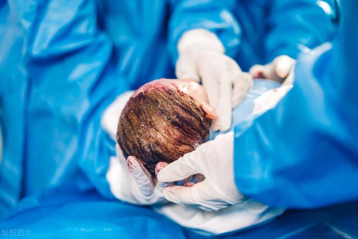 孕妇要求剖腹产医生可以拒绝吗,孕妇剖宫产必须家属同意吗