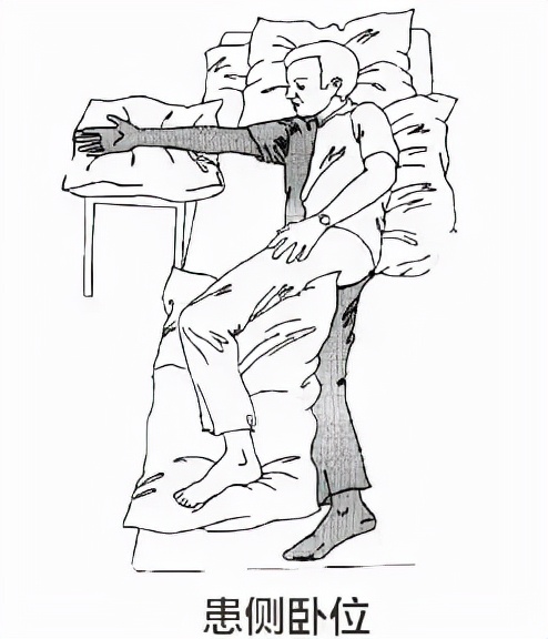 偏瘫早期康复之良肢位摆放,脑梗患者晚上睡觉怎样摆放姿势