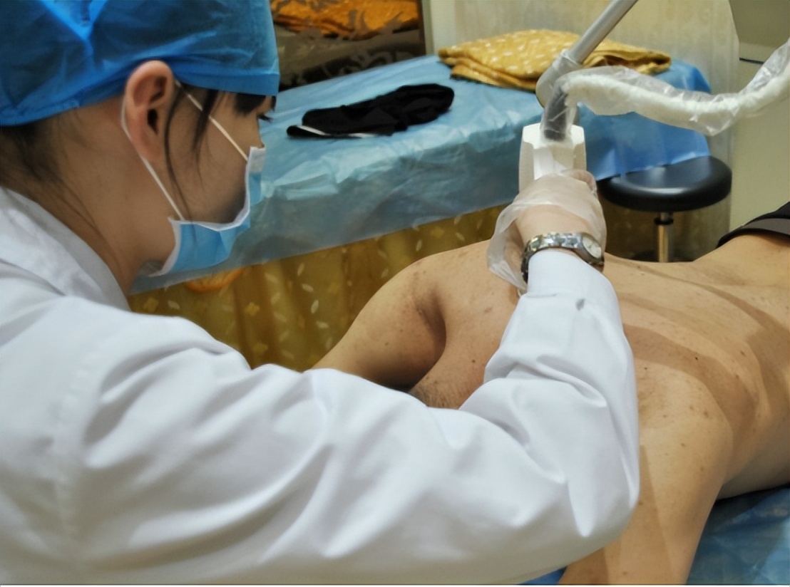 脖子上有丝状疣和皮赘怎么办,丝状疣和丝状皮赘怎么区别