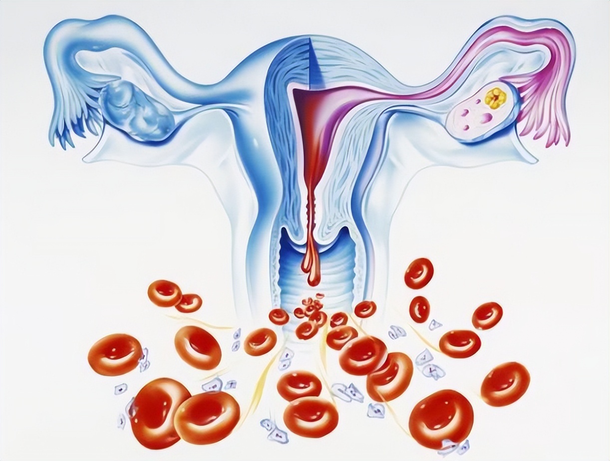 为什么月经结束后，会出现“褐色分泌物”呢？若是你也有，要重视
