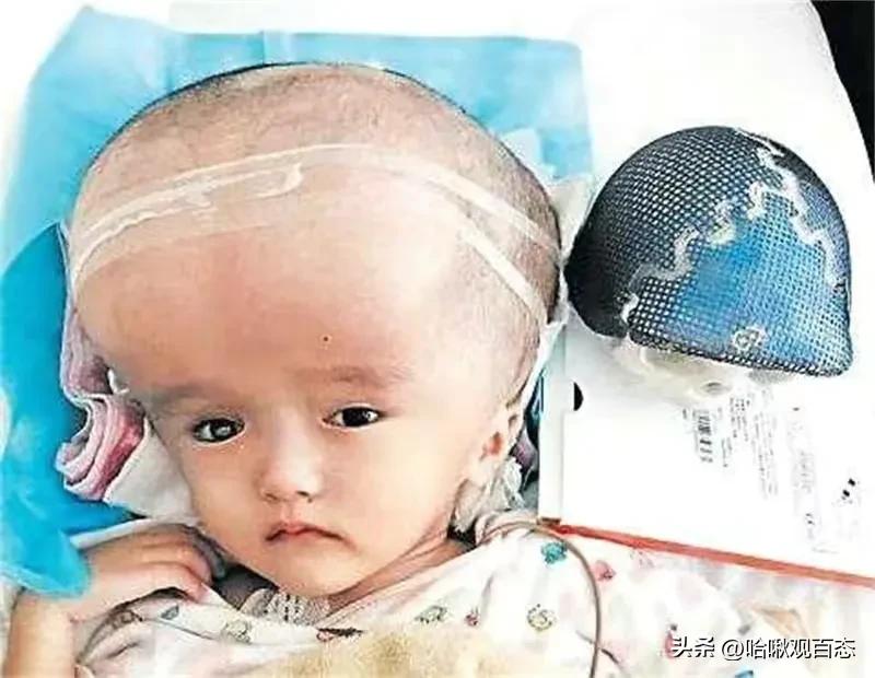 曾经的三鹿毒奶粉事件让许多婴幼儿饱受疾病带来的痛苦，太可怜了