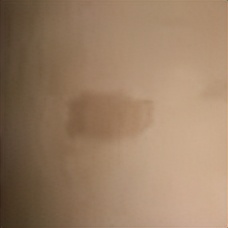 新生儿有胎记,新生儿身上有胎记怎么处理