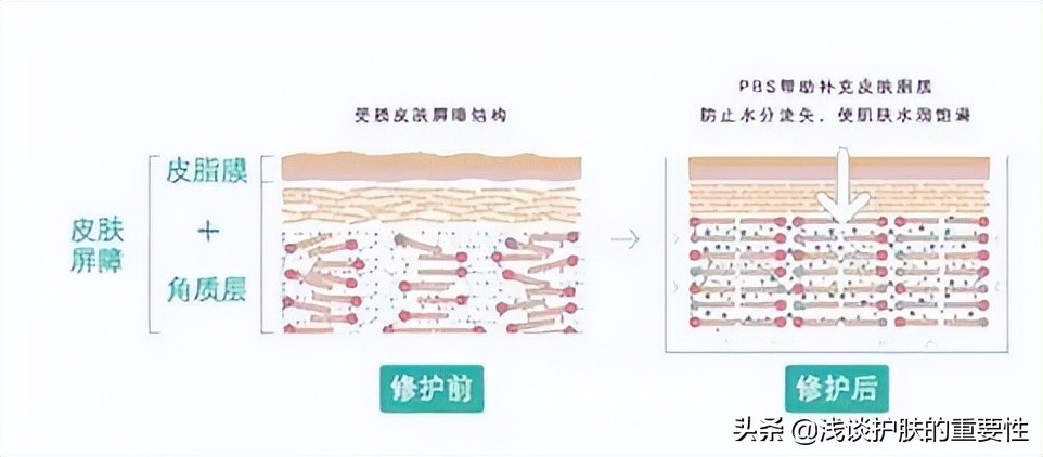 护肤品是否温和，选择适合自己的方法有哪些？