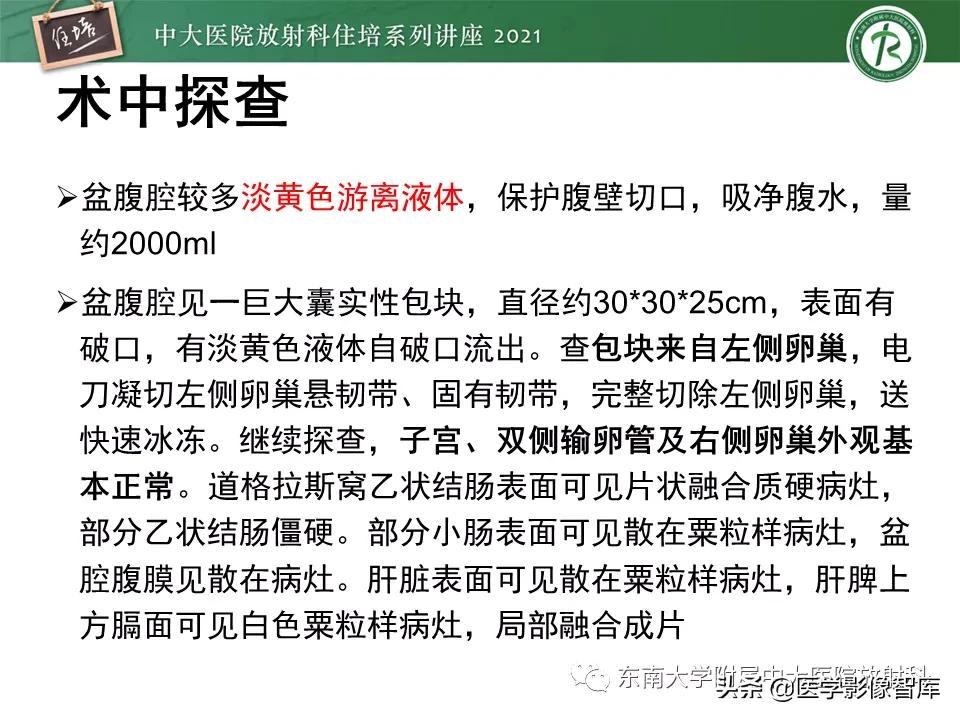 卵巢浆液性肿瘤的肉眼及镜下特征,卵巢原发性粘液性囊腺瘤