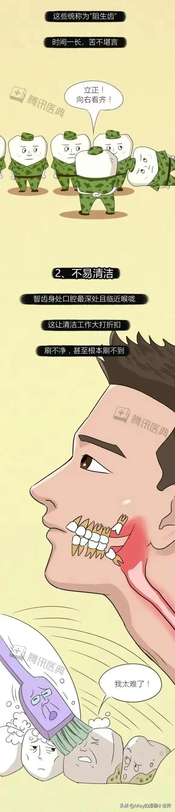 下智齿拔了上智齿正常不拔后果,不拔智齿怀孕有影响吗