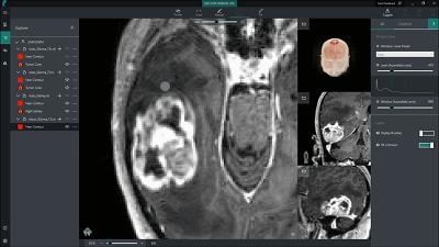 计算机视觉如何改变未来,计算机视觉：算法与应用